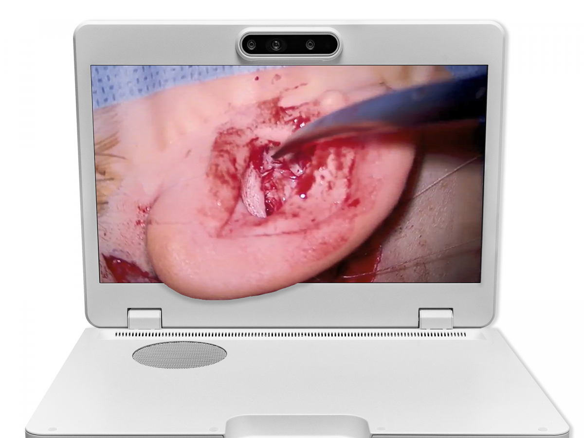 达擎之＂Heads-up 3D显微手术显示系统＂，整合4K裸眼3D显示及眼球追踪系统，具备快速追踪人眼移动位置功能，减轻医师长时间维持固定姿势的负担，让医师能有更宽广清晰的3D立体视野及更舒适的姿势来执行手术。